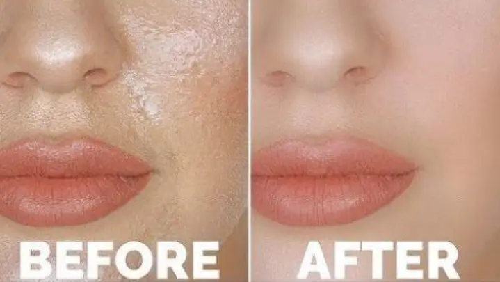 Best tinted sunscreen for oily skin before and after