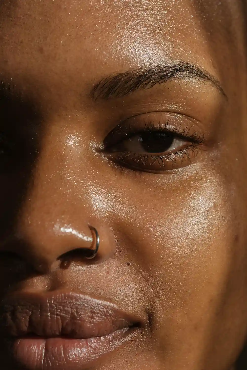 Hormonal Causes of Oily Skin